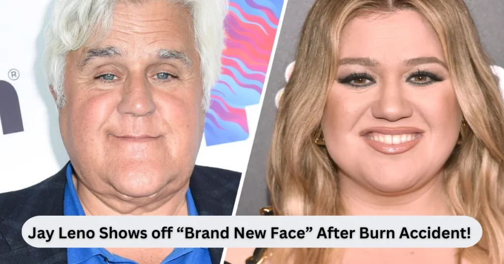 Jay Leno Shows Off “Brand New Face” After Burn Accident!