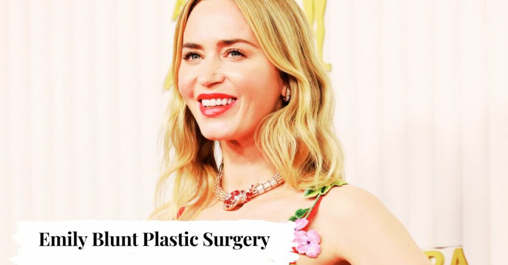 Emily Blunt Plastic Surgery